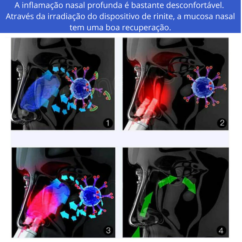 Bionase Terapia Nasal